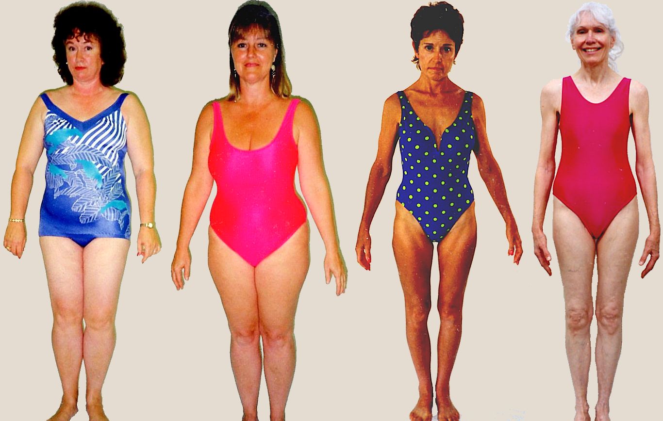 Pictures of female Pituitary body type