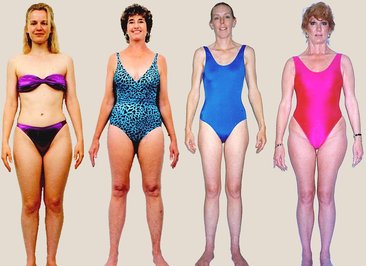 Pictures of female Thymus body type
